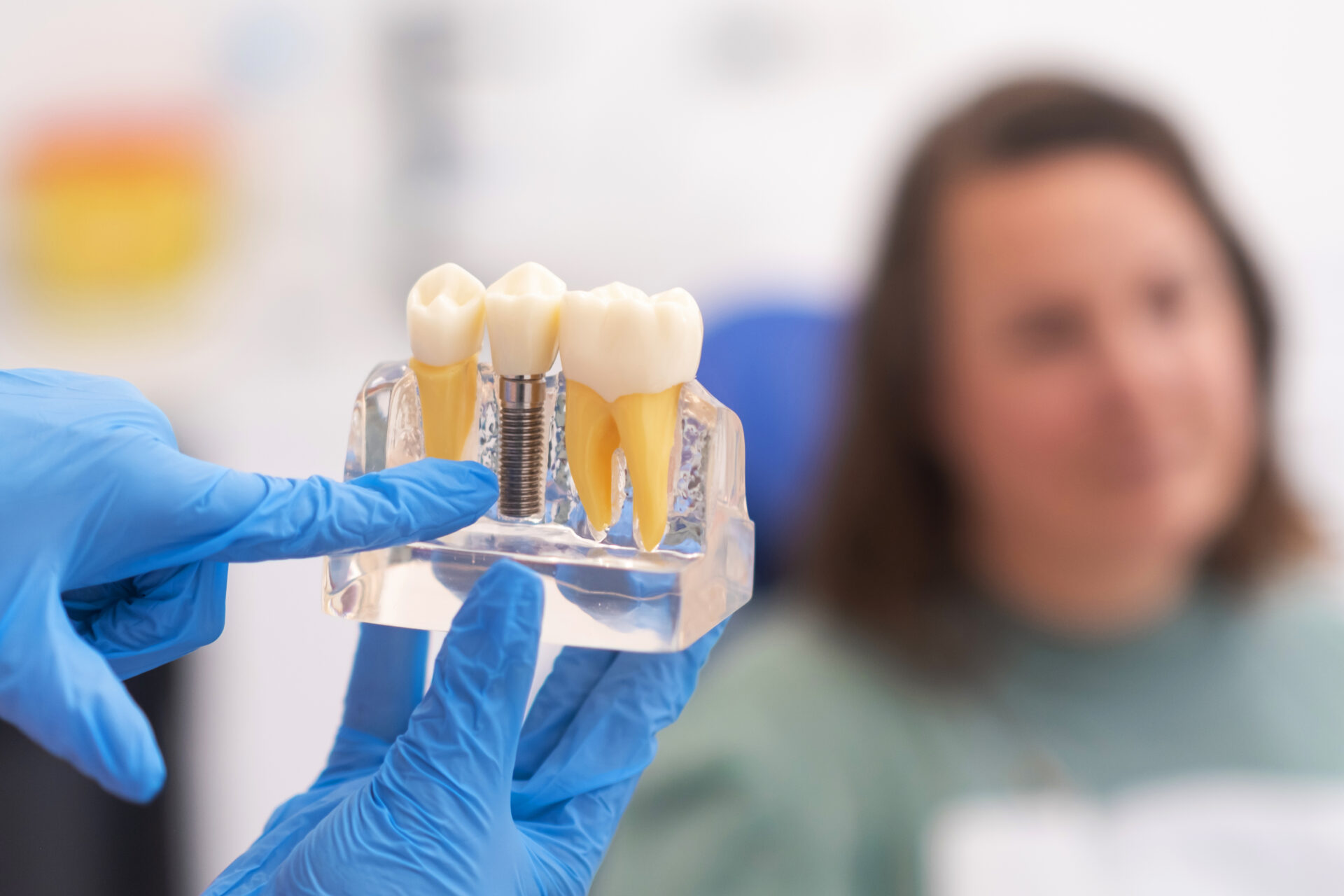 Implantologie in der Potsdam Oralchirurgie