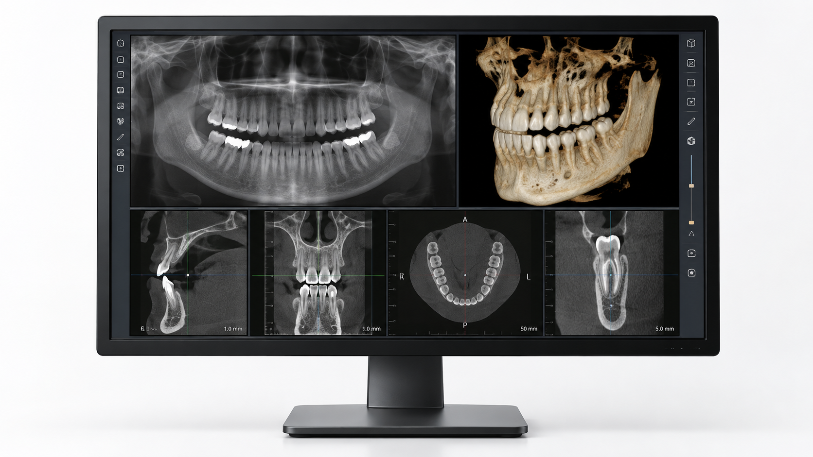 Digitale Volumentomographie DVT – dreidimensionale Darstellung des Kiefers